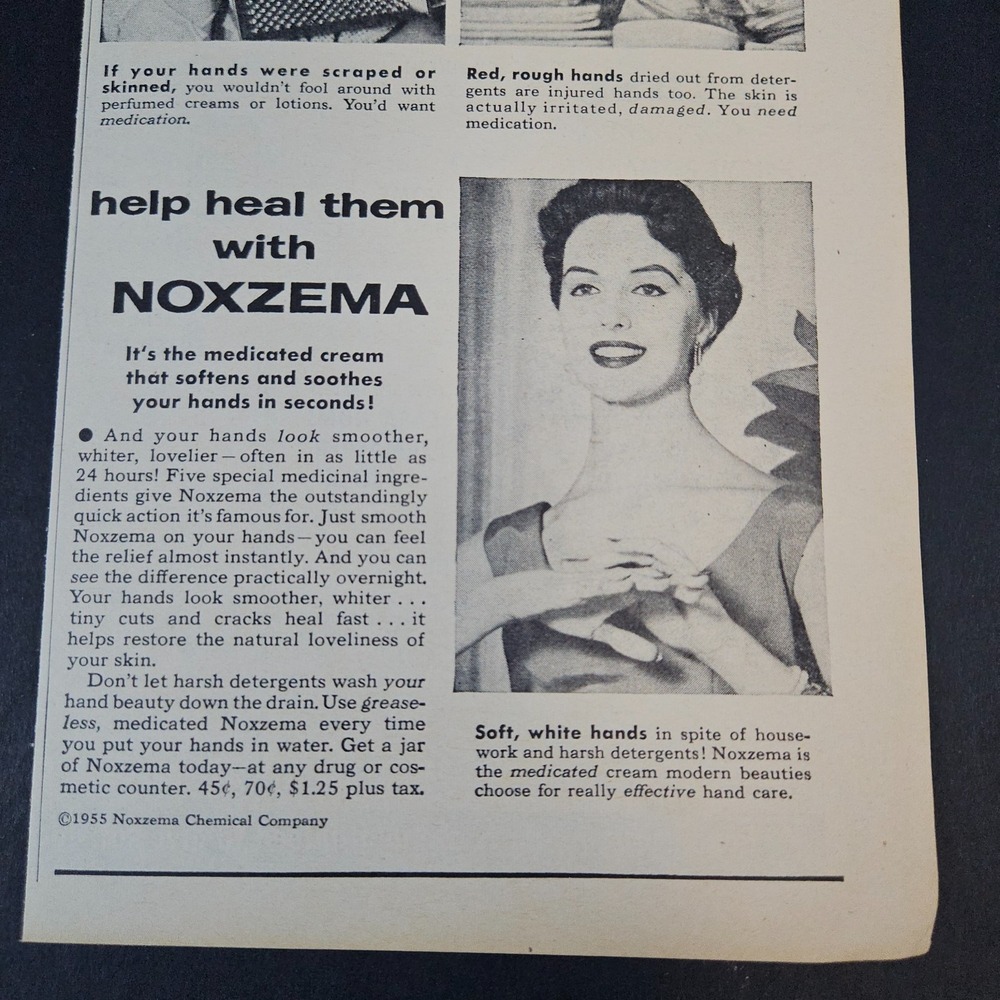 1955 Noxzema Chemical Company Heals Detergent Hands Vintage Print Ad Medicated